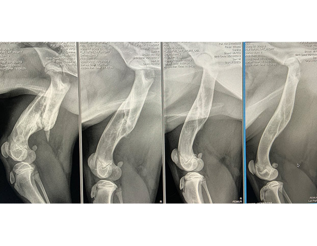 Broken Leg