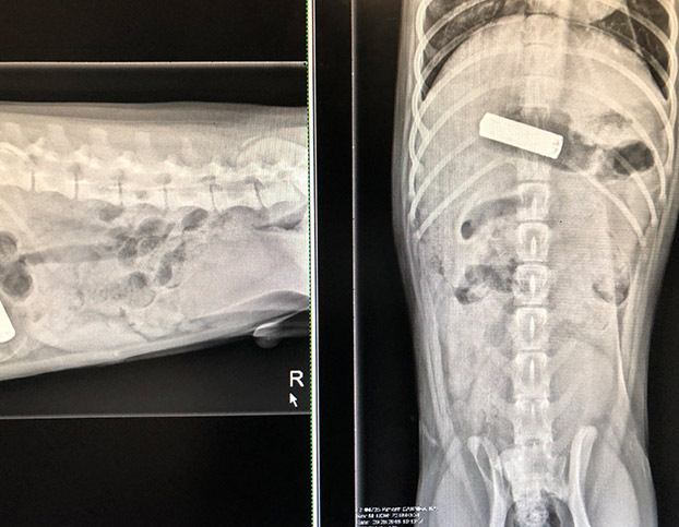 Abdominal X-ray